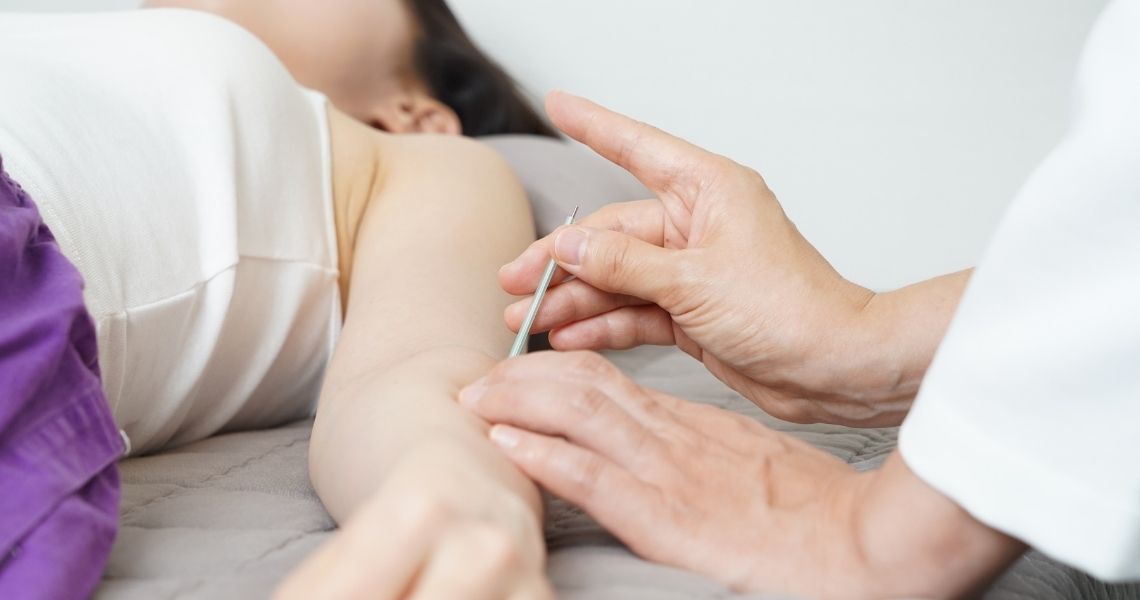 What Is Acupuncture and How Does It Work? A Beginner’s Guide
