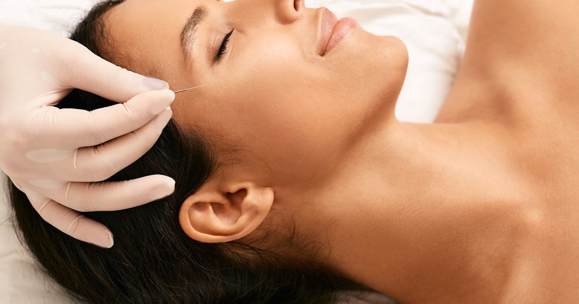 How Does Acupuncture Work? Benefits, Process & What to Expect