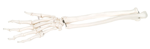 3B Scientific Anatomical Model - loose bones, hand skeleton with ulna and radius, right (bungee) - Includes 3B Smart Anatomy