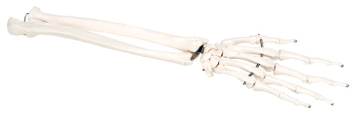 3B Scientific Anatomical Model - loose bones, hand skeleton with ulna and radius (wire) - Includes 3B Smart Anatomy