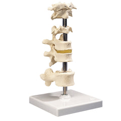 3B Scientific Anatomical Model - 6 mounted vertebrae with removable stand - Includes 3B Smart Anatomy