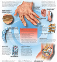 Anatomical Chart - rheumatic diseases, laminated