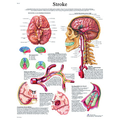 Anatomical Chart - stroke chart paper