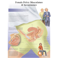 Anatomical Chart - female urinary incontinence chart, laminated