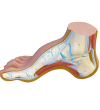 3B Scientific Anatomical Model - Hollow Foot (Pes Cavus) - Includes 3B Smart Anatomy