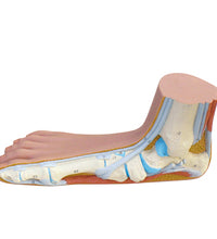 3B Scientific Anatomical Model - Flat Foot (Pes Planus) - Includes 3B Smart Anatomy