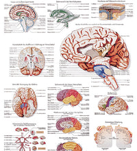 Anatomical Chart - human brain, laminated