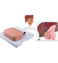 Gallbladder Set