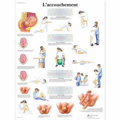 L'accouchement