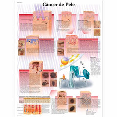 Câncer de Pele