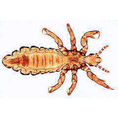 Insect (Insecta) - English Slides