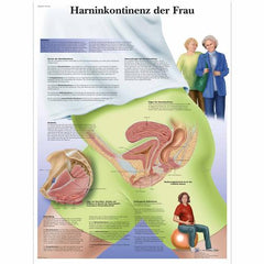 Harninkontinenz der Frau
