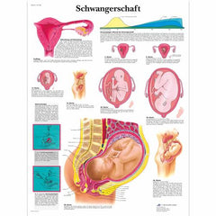 Schwangerschaft
