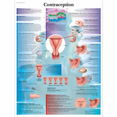 Contraception