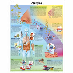 Alergias, 50x67 cm, Versao Papel
