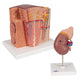 Kidney Set
