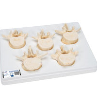 Set of  5 BONElike Lumbar Vertebrae - 3B Smart Anatomy