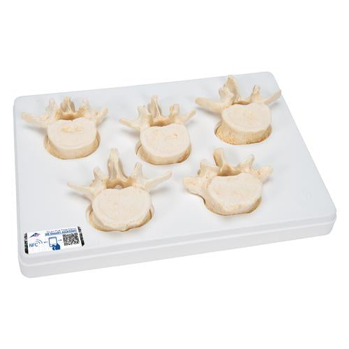 Set of  5 BONElike Lumbar Vertebrae - 3B Smart Anatomy