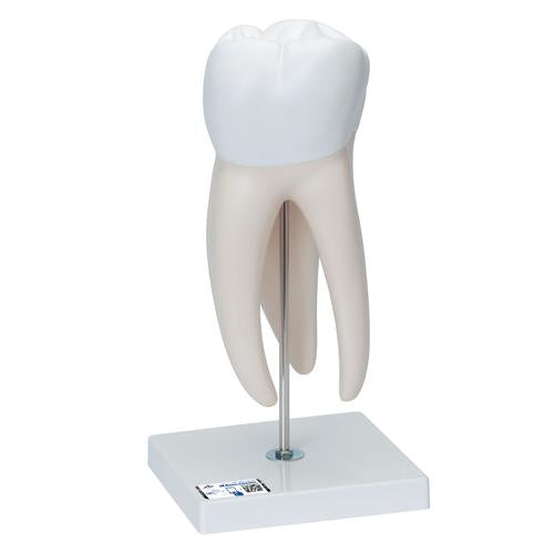Giant Molar with Dental Cavities Human Tooth Model, 15 times Life-Size, 6 part - 3B Smart Anatomy