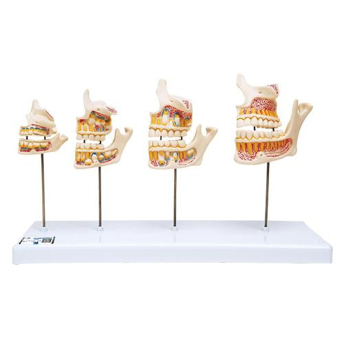Dentition Development Model - 3B Smart Anatomy