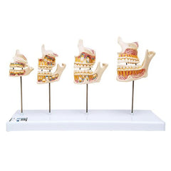 Dentition Development Model - 3B Smart Anatomy