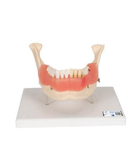 Dental Disease Model, Magnified 2 times, 21 parts - 3B Smart Anatomy