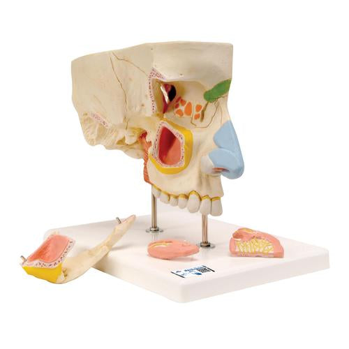 Human Nose Model with Paranasal Sinuses, 5 part - 3B Smart Anatomy