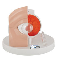 Pathological Human Eye Model - 3B Smart Anatomy
