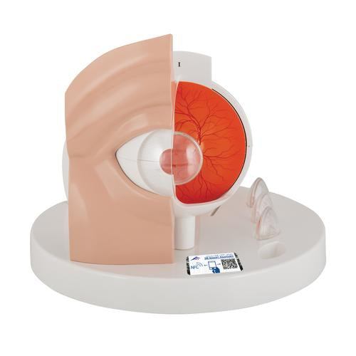 Pathological Human Eye Model - 3B Smart Anatomy