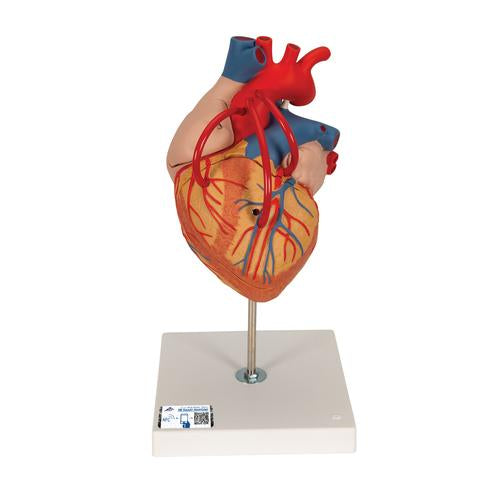 Human Heart Model with Bypass, 2 times Life-Size, 4 part - 3B Smart Anatomy
