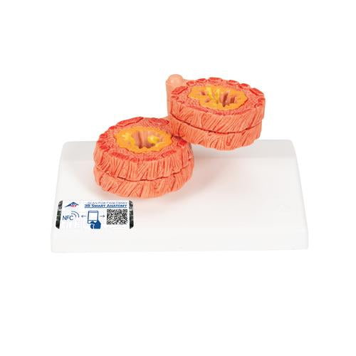 COPD Bronchial Tissue Model - 3B Smart Anatomy