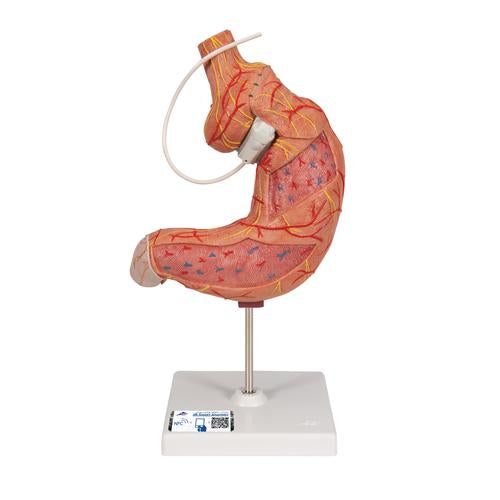 Human Stomach Model with Gastric Band, 2 part - 3B Smart Anatomy