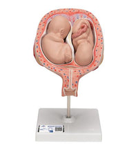 Twin Fetuses Model, 5th Month in Normal Position - 3B Smart Anatomy