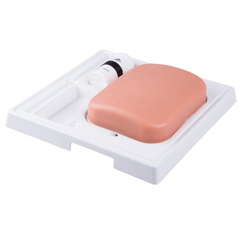 SONOtrain Foreign body model