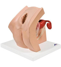 Model for GynaecologicalPatient Education - 3B Smart Anatomy