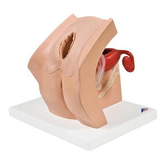 Model for GynaecologicalPatient Education - 3B Smart Anatomy