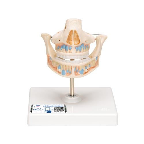 Milk Denture Model with Remaining Teeth - 3B Smart Anatomy