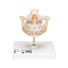 Milk Denture Model with Remaining Teeth - 3B Smart Anatomy