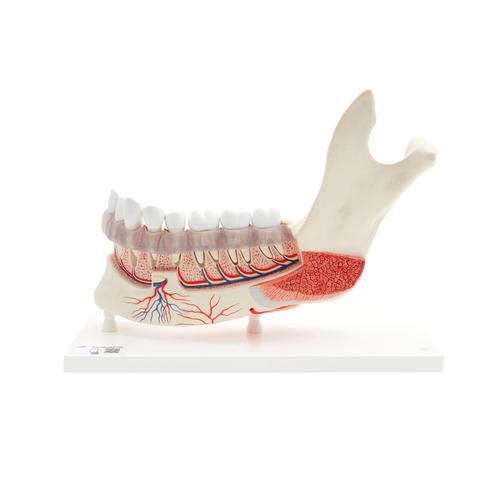 Comprehensive Lower Jaw Model (Left Half) with Diseased Teeth, Nerves, Vessels & Glands, 19 part - 3B Smart Anatomy