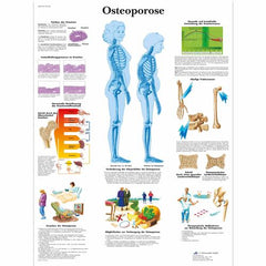 Osteoporose Chart