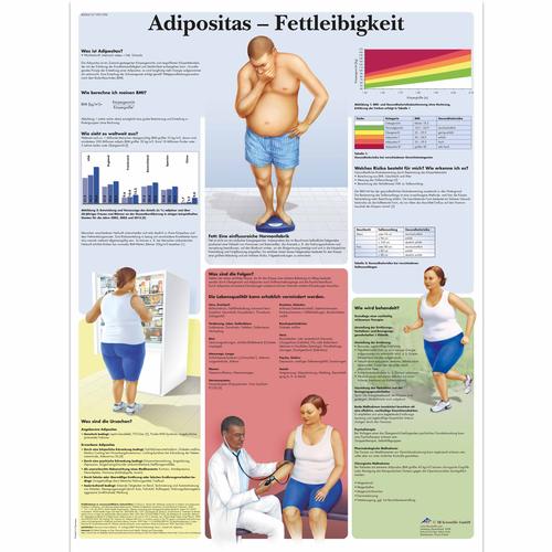 Adipositas - Fettleibigkeit