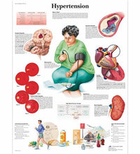 Hypertension Chart
