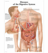 Diseases of the Digestive System Chart