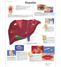Hepatitis Chart