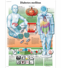 Diabetes Mellitus Chart