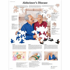 Alzheimer's Disease Chart