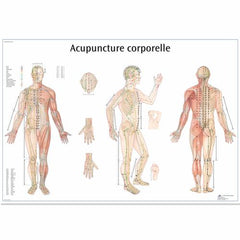 Acupuncture corporelle