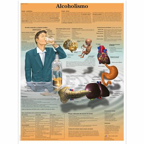 Alcoholismo