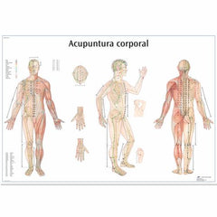 Acupuntura corporal