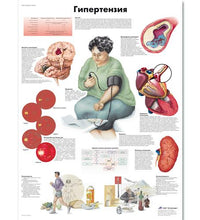 Hypertension Chart